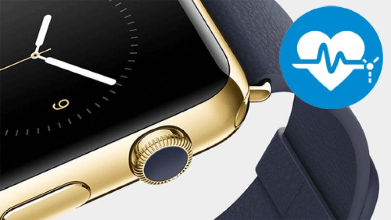 IWatch Gold, chi comprer&